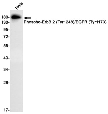 Anti-Phosoho-ErbB 2/EGFR (Tyr1248/Tyr1173) Rabbit Monoclonal Antibody