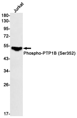 Anti-Phospho-PTP1B (Ser352) Rabbit Monoclonal Antibody