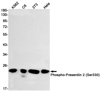 Anti-Phospho-Presenilin 2 (Ser330) Rabbit Monoclonal Antibody