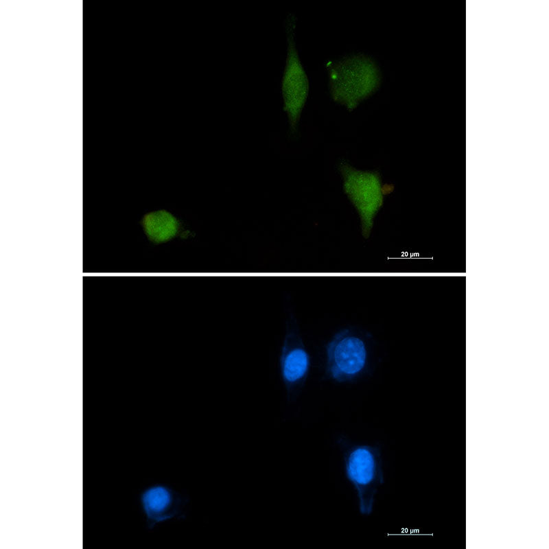 Anti-Phospho-delta 1 Catenin (Tyr228) Rabbit Monoclonal Antibody