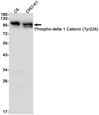 Anti-Phospho-delta 1 Catenin (Tyr228) Rabbit Monoclonal Antibody