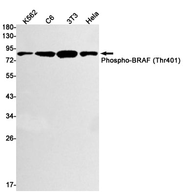 Anti-Phospho-BRAF (Thr401) Rabbit Monoclonal Antibody