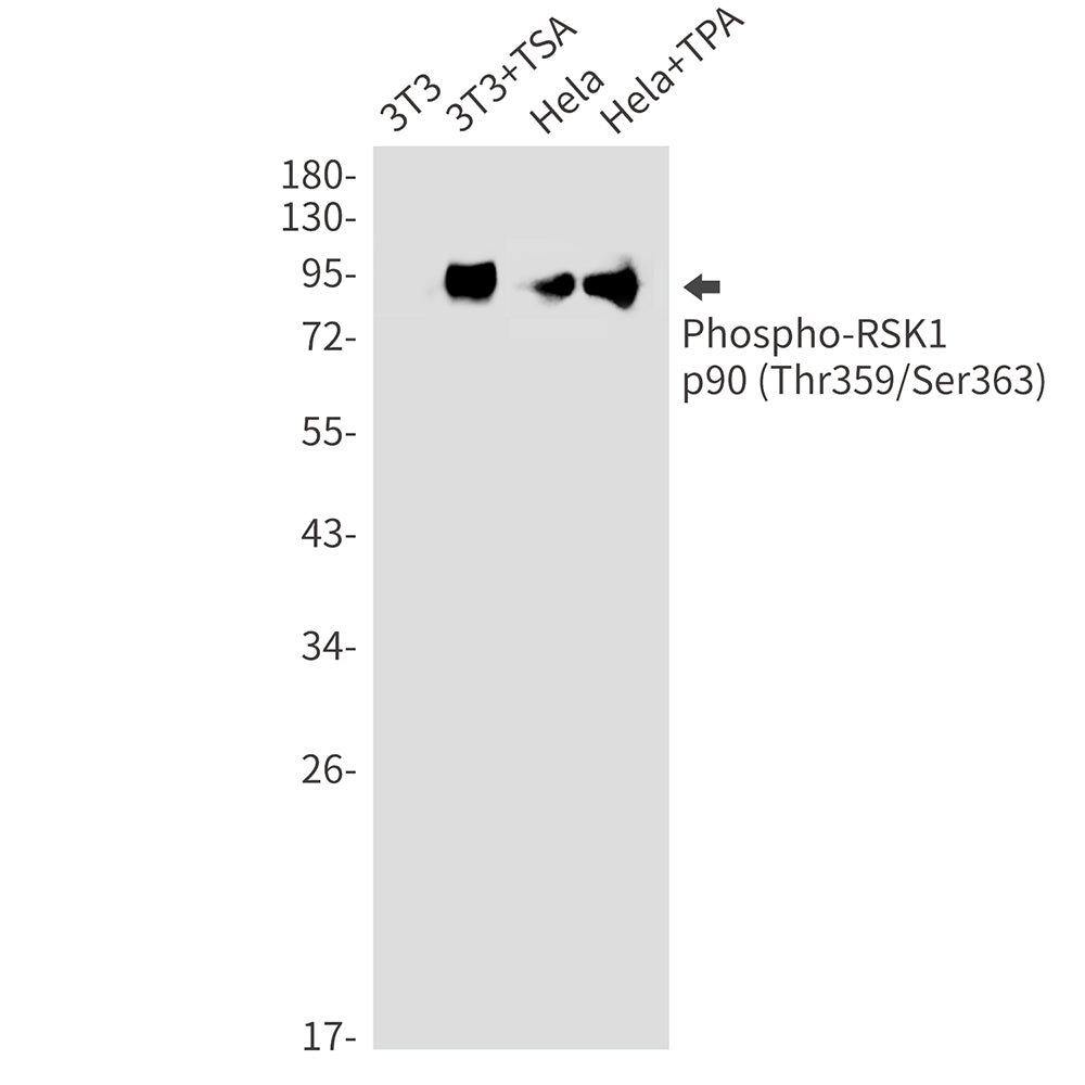 Anti-Phospho-RSK1 p90 (Thr359/Ser363) Rabbit Monoclonal Antibody