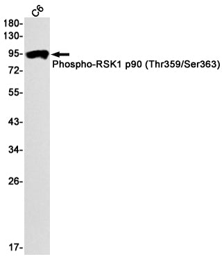 Anti-Phospho-RSK1 p90 (Thr359/Ser363) Rabbit Monoclonal Antibody