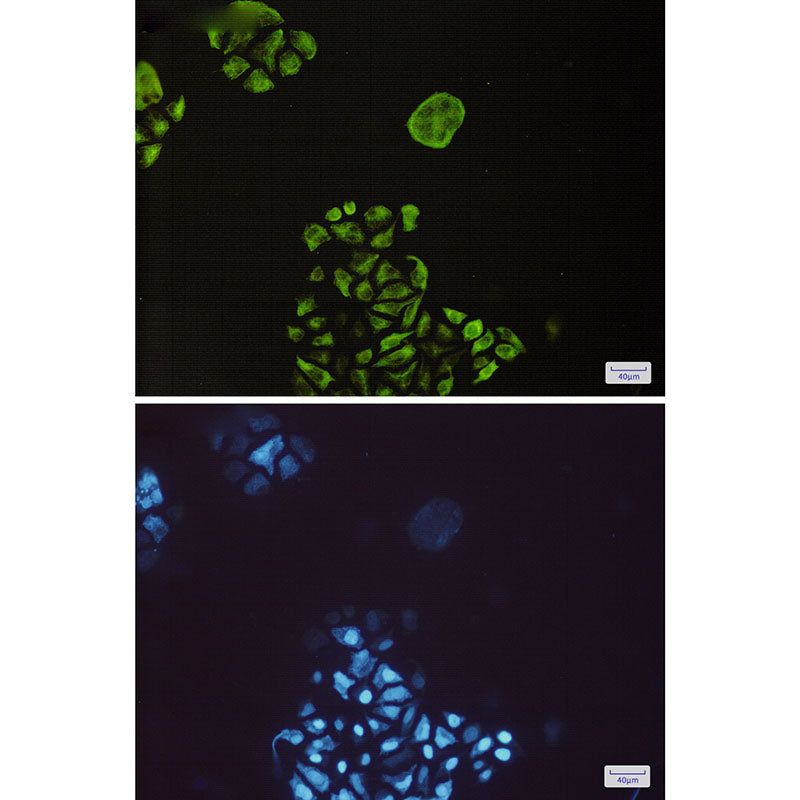 Anti-Phospho-GSK3 beta (Ser9) Rabbit Monoclonal Antibody