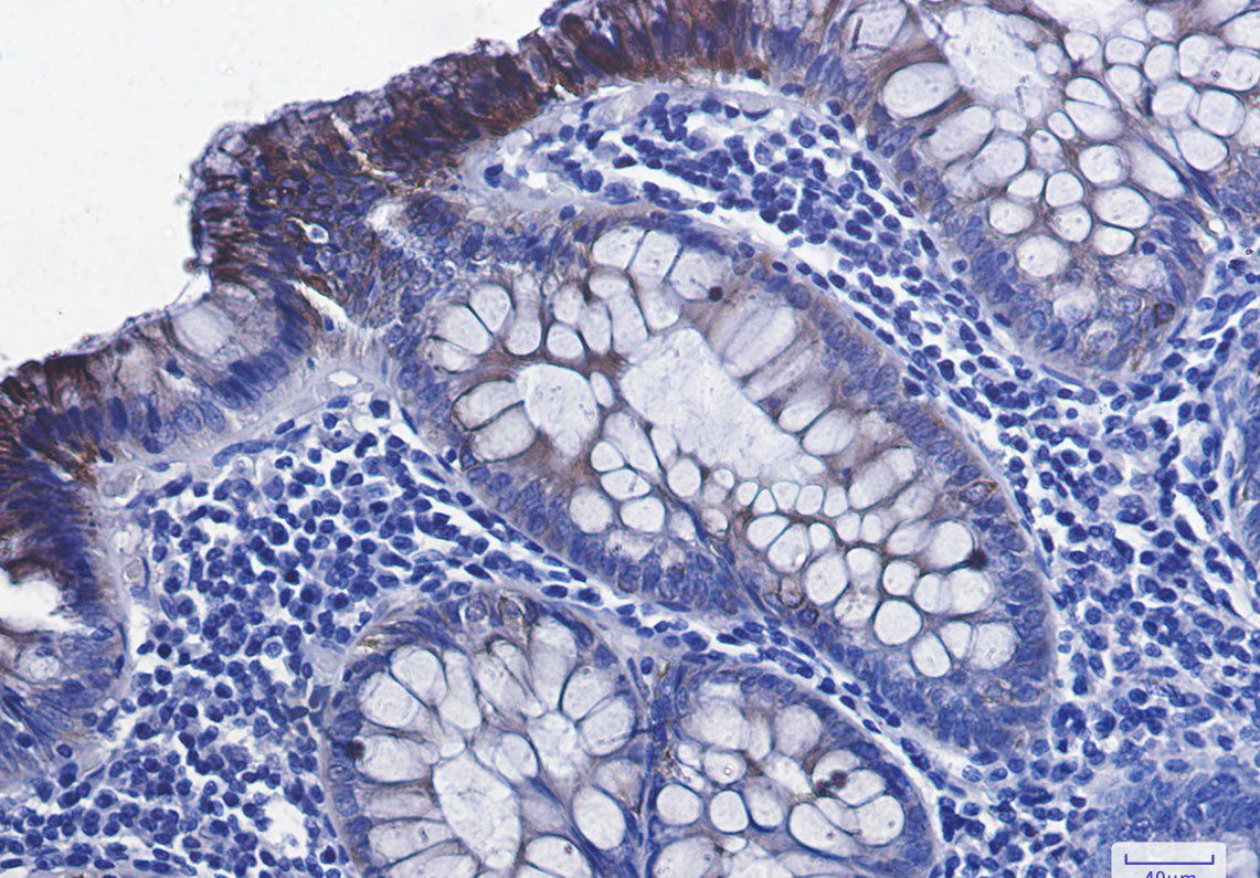 Anti-Phospho-GSK3 beta (Ser9) Rabbit Monoclonal Antibody