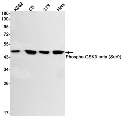 Anti-Phospho-GSK3 beta (Ser9) Rabbit Monoclonal Antibody