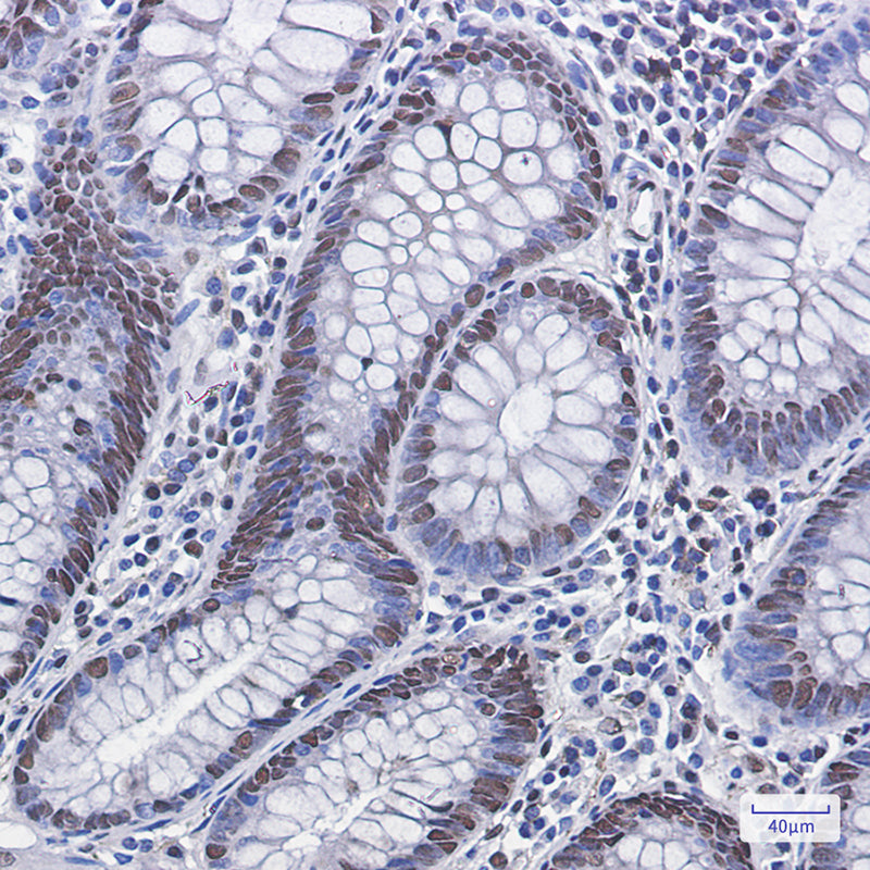 Anti-Phospho-MDM2 (Ser166) Rabbit Monoclonal Antibody