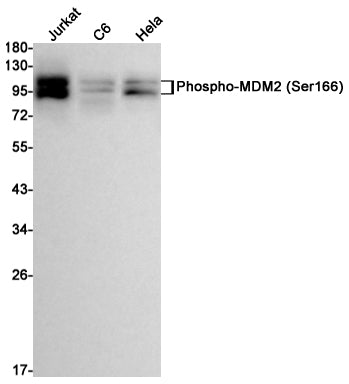 Anti-Phospho-MDM2 (Ser166) Rabbit Monoclonal Antibody