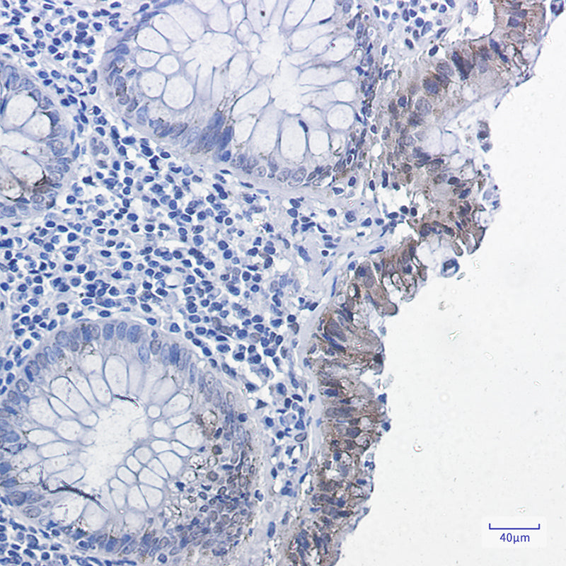 Anti-Phospho-Smad2 (Ser255) Rabbit Monoclonal Antibody