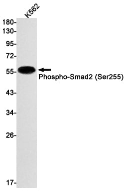 Anti-Phospho-Smad2 (Ser255) Rabbit Monoclonal Antibody