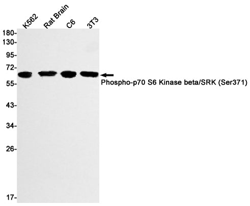 Anti-Phospho-S6K2 (Ser371) Rabbit Monoclonal Antibody