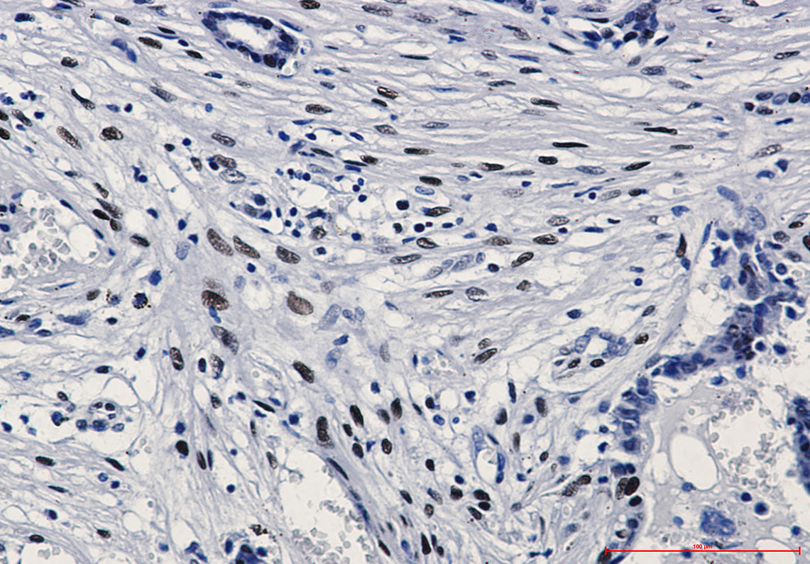 Anti-Phospho-c-Jun (Ser63) Rabbit Monoclonal Antibody