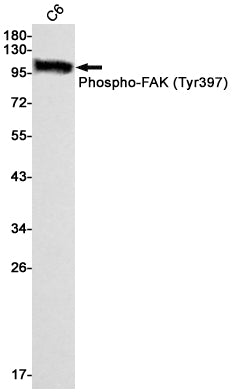 Anti-Phospho-FAK (Tyr397) Rabbit Monoclonal Antibody