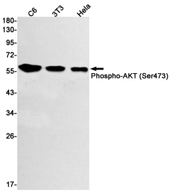 Anti-Phospho-AKT (Ser473) Rabbit Monoclonal Antibody