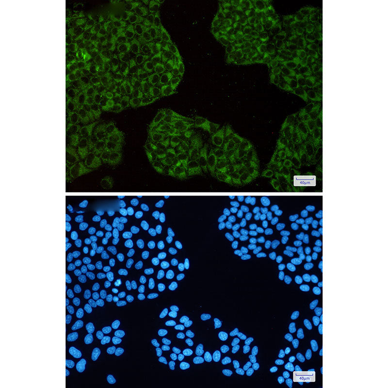 Anti-Ferritin Heavy Chain Rabbit Monoclonal Antibody