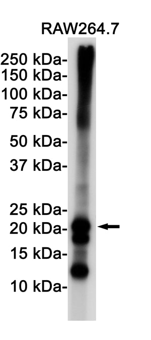 Anti-Ferritin Heavy Chain Rabbit Monoclonal Antibody