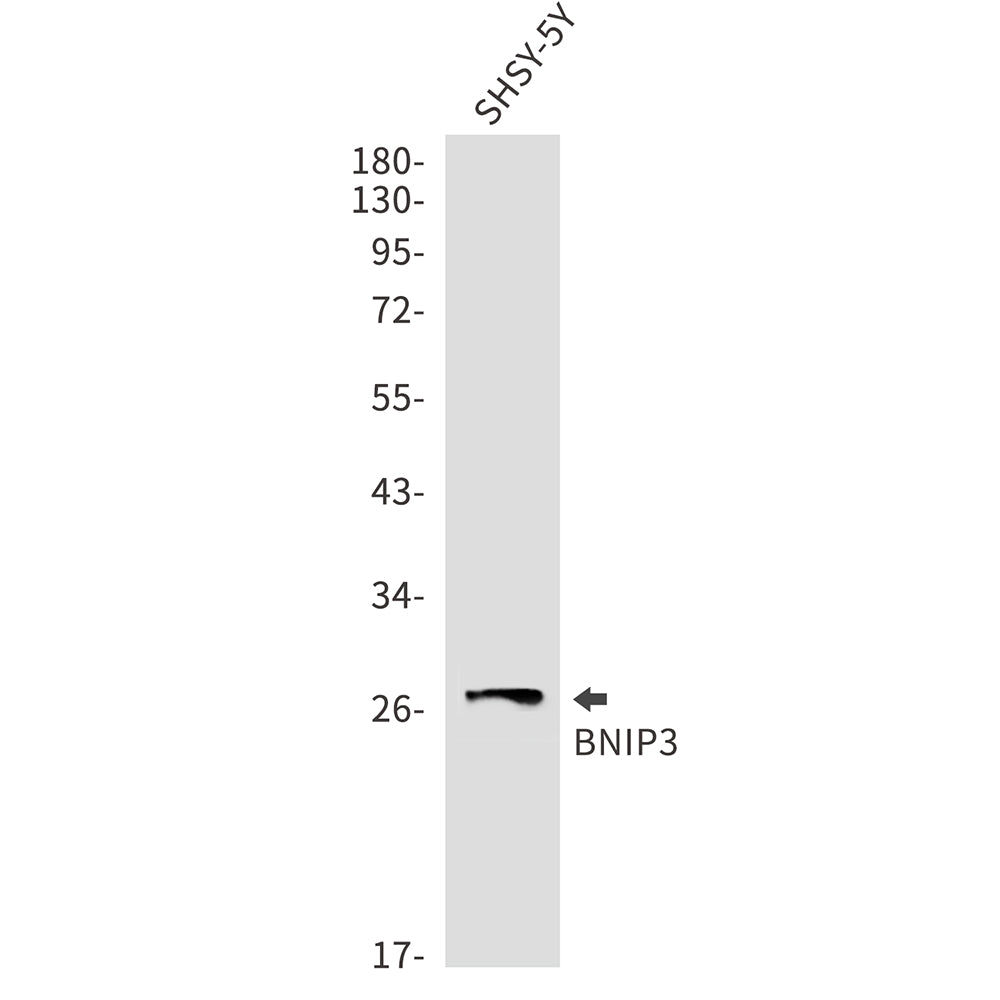 Anti-BNIP3 Rabbit Monoclonal Antibody
