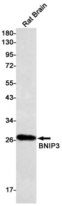 Anti-BNIP3 Rabbit Monoclonal Antibody