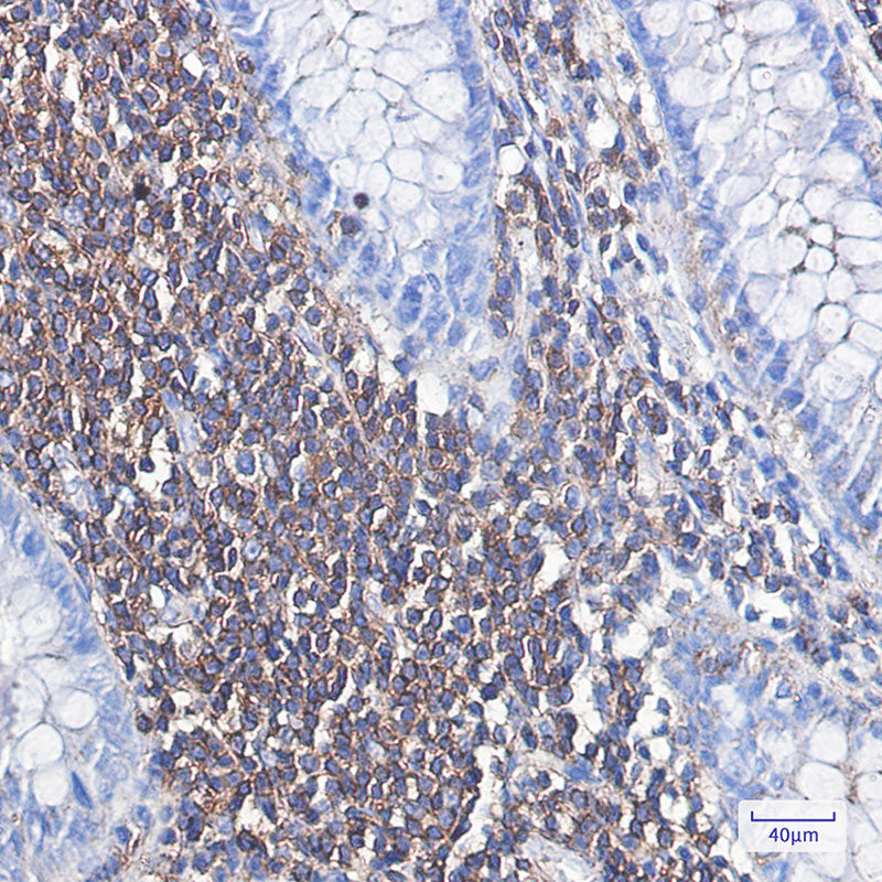 Anti-alpha Skeletal Muscle Actin Rabbit Monoclonal Antibody