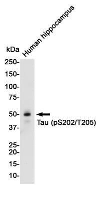 Anti-Phospho-Tau (Ser202/Thr205) Rabbit Monoclonal Antibody