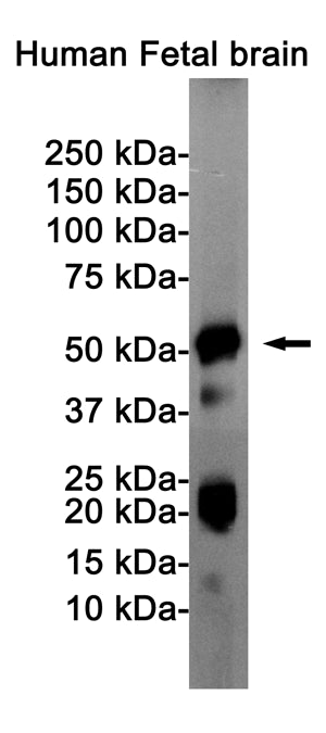Anti-Phospho-Tau (Ser404) Rabbit Monoclonal Antibody