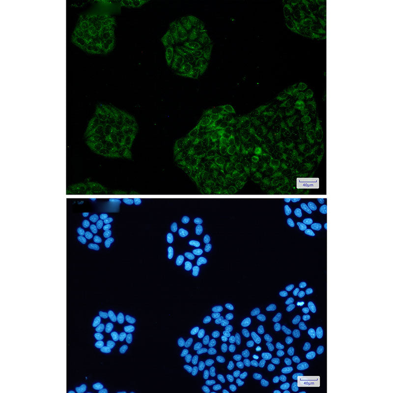 Anti-Amyloid Precursor Protein Rabbit Monoclonal Antibody