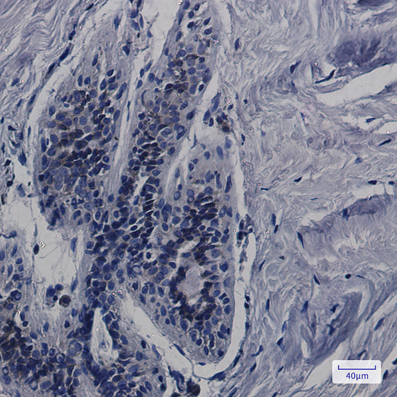 Anti-CDK5RAP3 Rabbit Monoclonal Antibody
