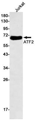 Anti-ATF2 Rabbit Monoclonal Antibody