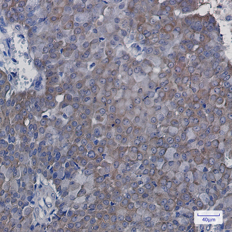 Anti-eIF5A Rabbit Monoclonal Antibody