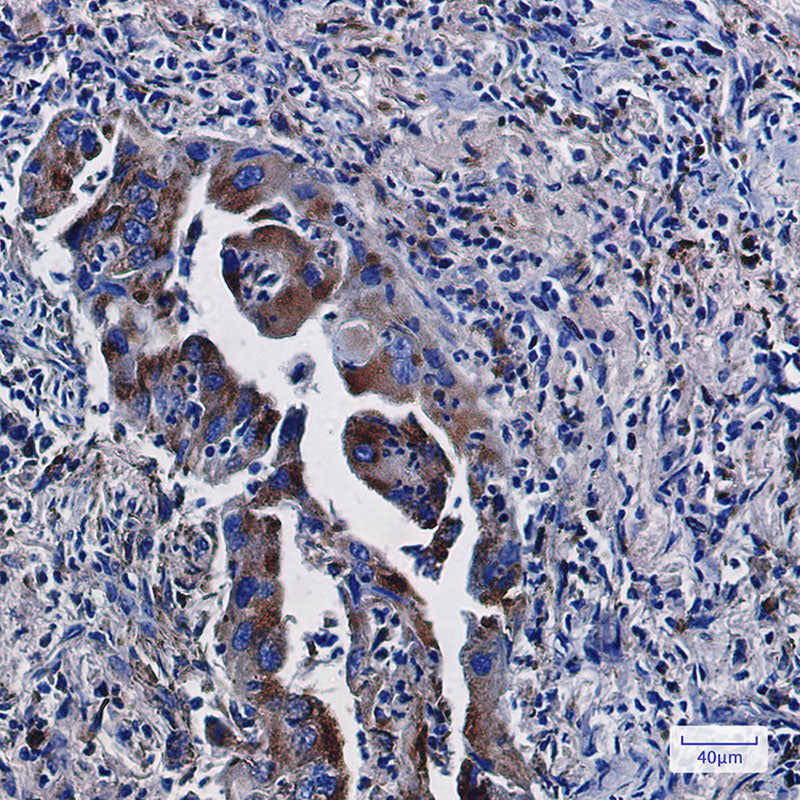 Anti-LAMP2 Rabbit Monoclonal Antibody