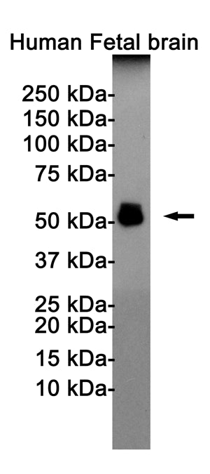 Anti-Phospho-Tau (Thr181) Rabbit Monoclonal Antibody