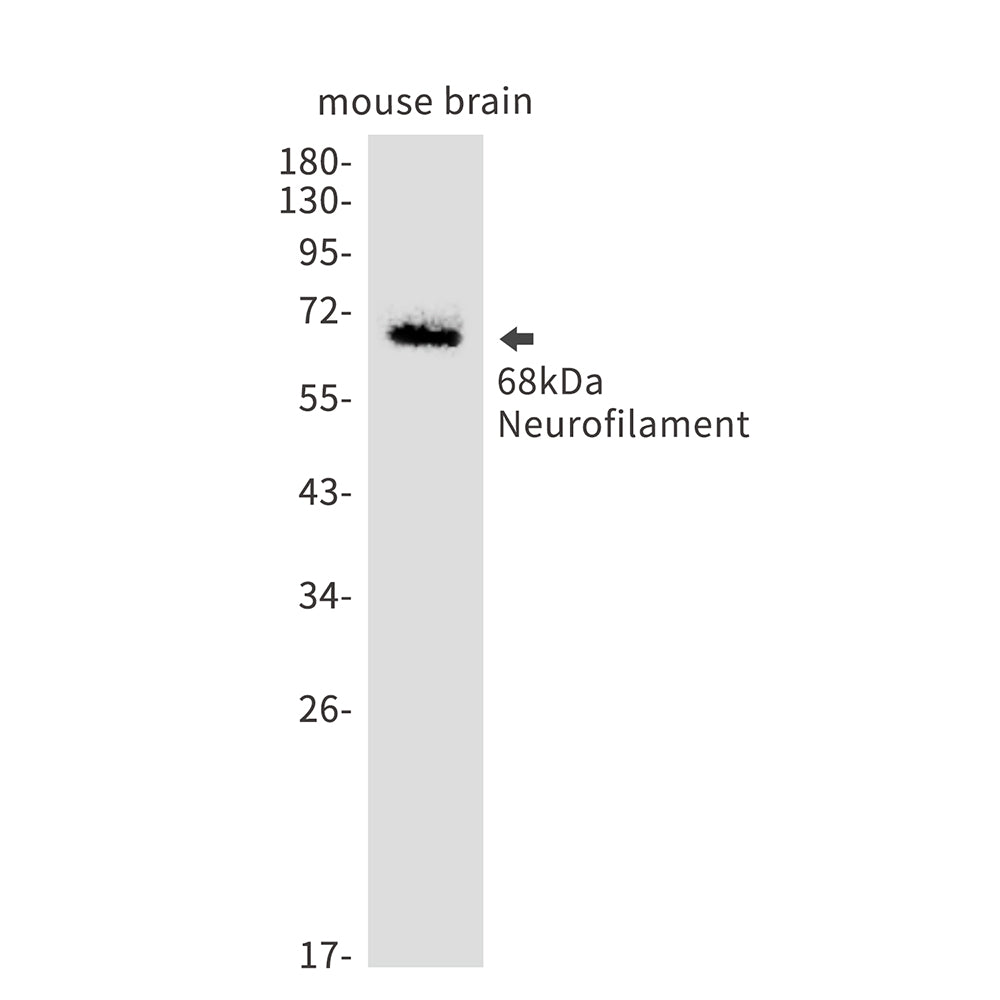 Anti-Neurofilament light polypeptide Rabbit Monoclonal Antibody