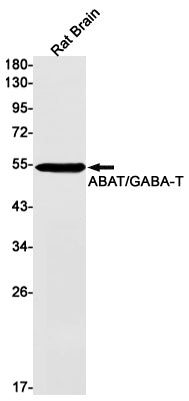 Anti-ABAT Rabbit Monoclonal Antibody