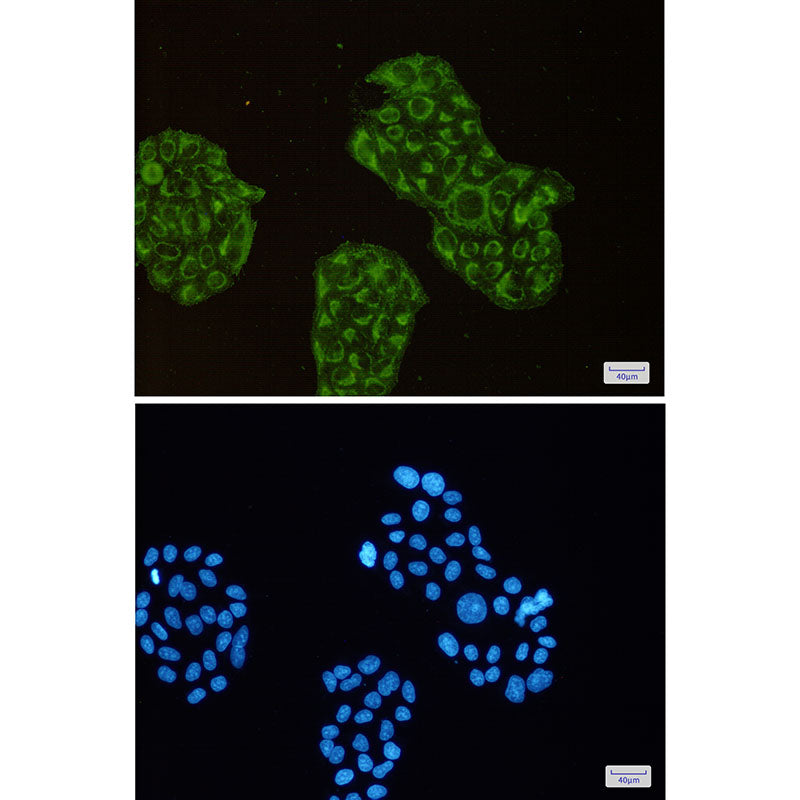 Anti-ACADM Rabbit Monoclonal Antibody