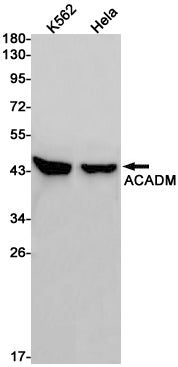 Anti-ACADM Rabbit Monoclonal Antibody