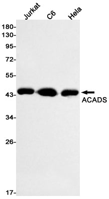 Anti-ACADS Rabbit Monoclonal Antibody