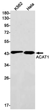 Anti-ACAT1 Rabbit Monoclonal Antibody