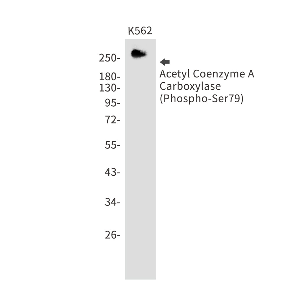 Anti-Phospho-Acetyl Coenzyme A Carboxylase (Ser79) Rabbit Monoclonal Antibody