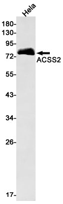 Anti-ACSS2 Rabbit Monoclonal Antibody