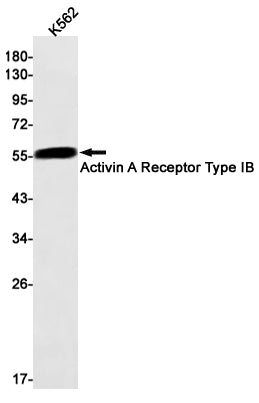 Anti-Activin A Receptor Type IB Rabbit Monoclonal Antibody