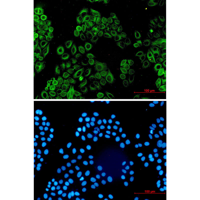 Anti-Activin A Receptor Type IB Rabbit Monoclonal Antibody