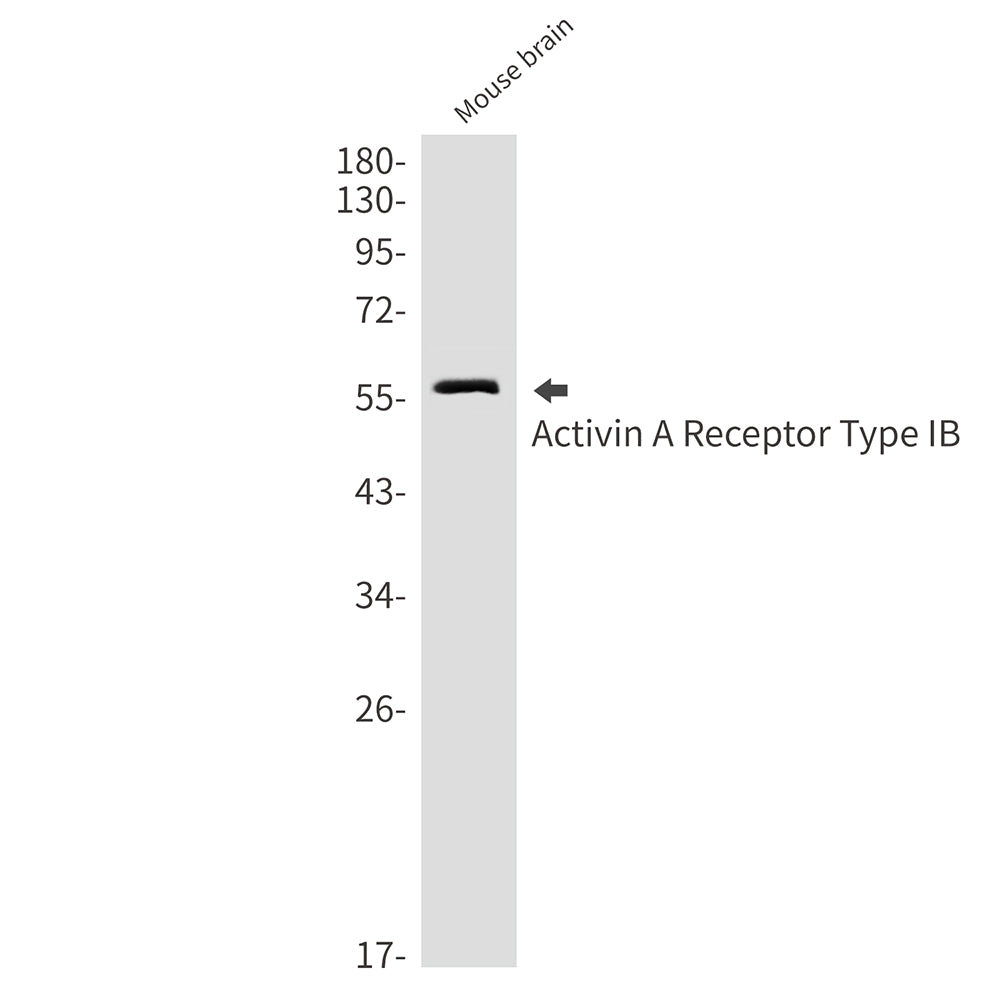 Anti-Activin A Receptor Type IB Rabbit Monoclonal Antibody