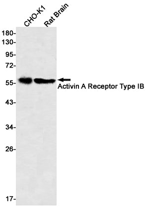 Anti-Activin A Receptor Type IB Rabbit Monoclonal Antibody