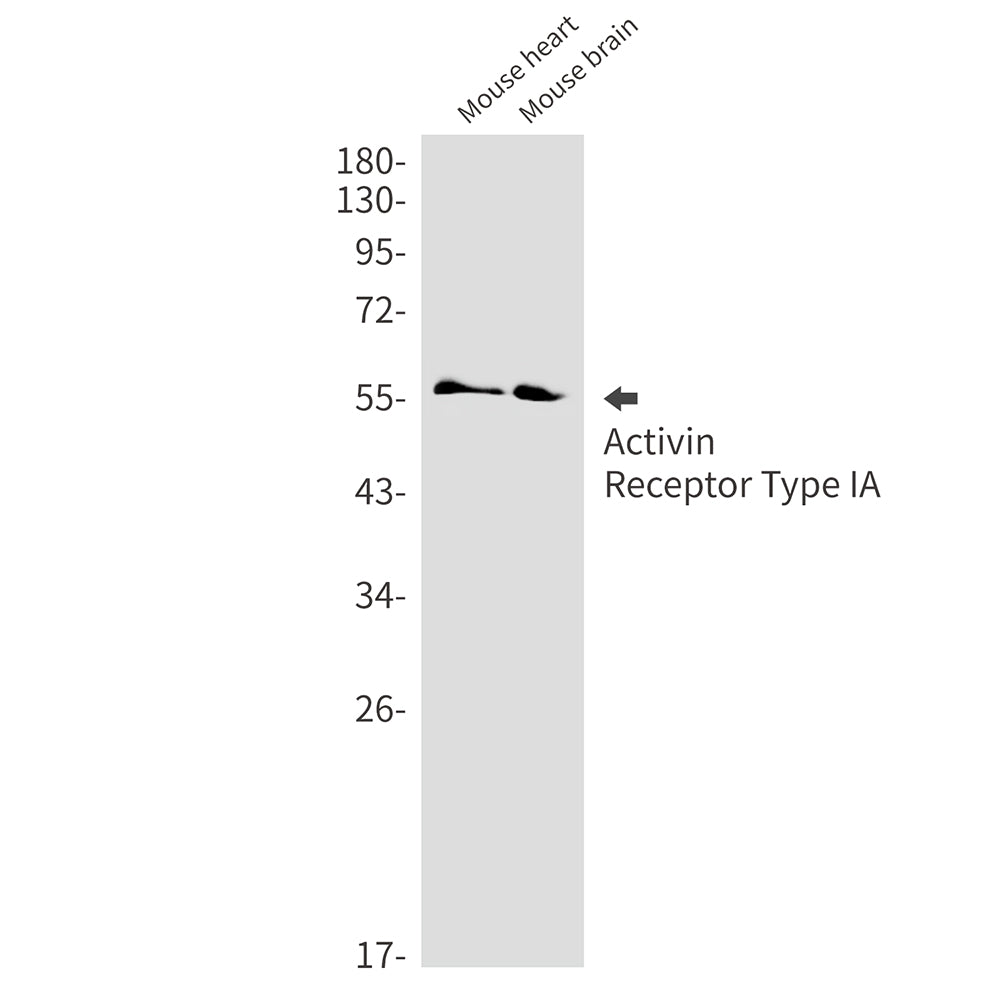Anti-Activin Receptor Type IA Rabbit Monoclonal Antibody