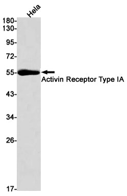 Anti-Activin Receptor Type IA Rabbit Monoclonal Antibody
