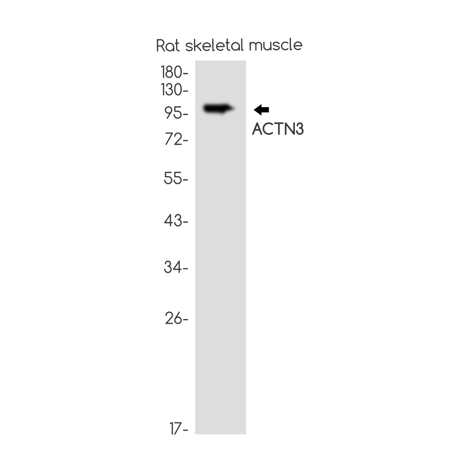 Anti-ACTN3 Rabbit Monoclonal Antibody