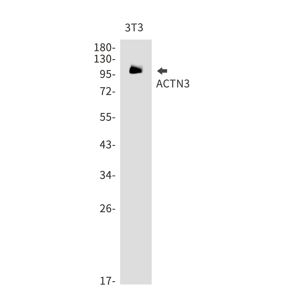 Anti-ACTN3 Rabbit Monoclonal Antibody