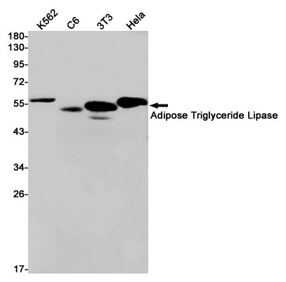 Anti-Adipose Triglyceride Lipase Rabbit Monoclonal Antibody