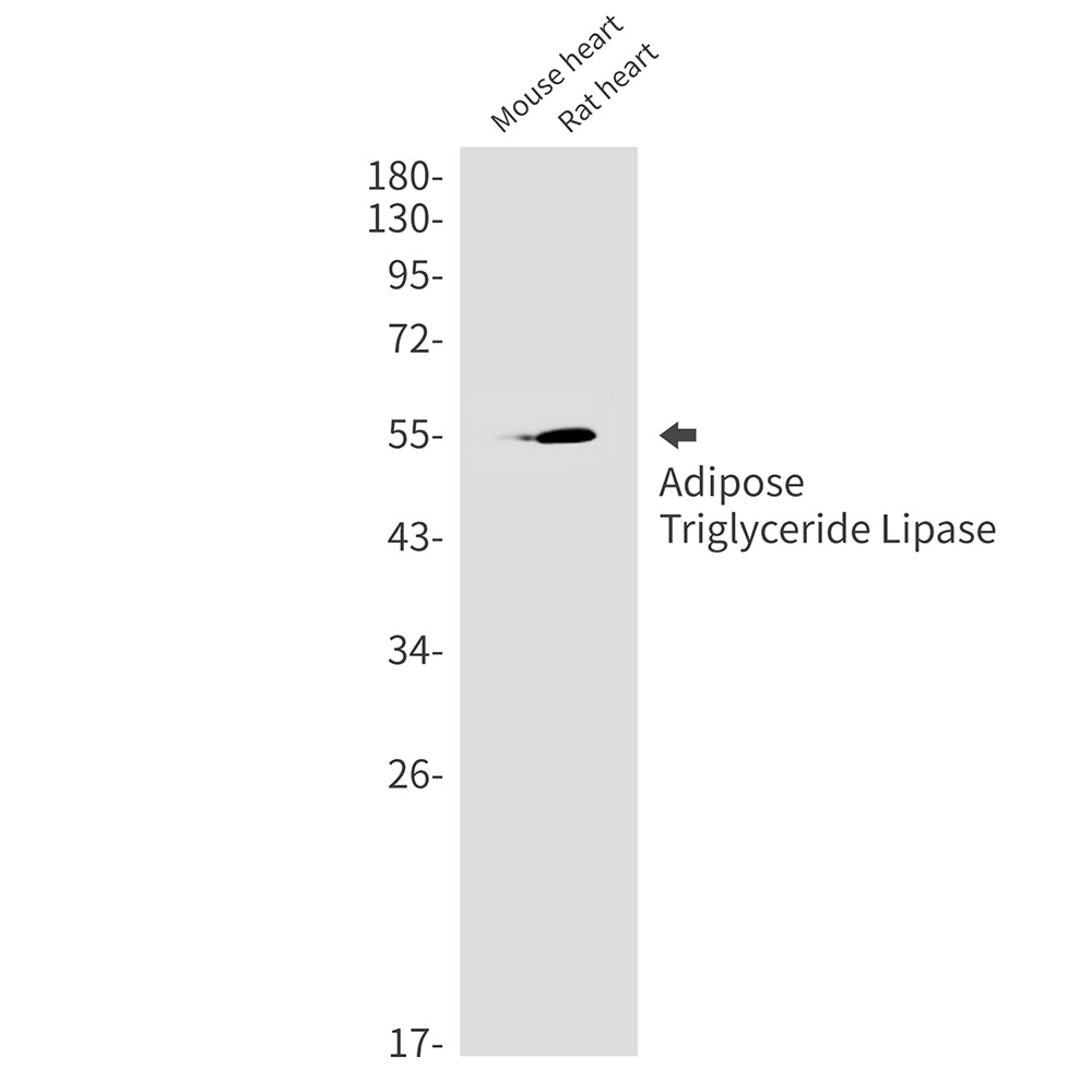 Anti-Adipose Triglyceride Lipase Rabbit Monoclonal Antibody